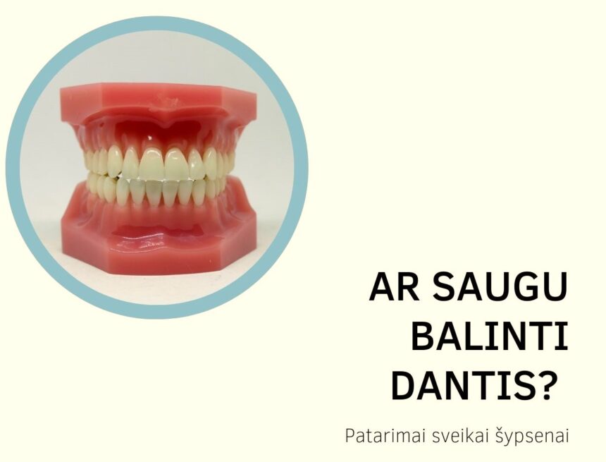 Ar saugu balinti dantis? Patarimai sveikai šypsenai Ar saugu balinti dantis? Patarimai sveikai šypsenai