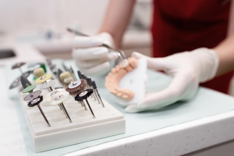 Kada reikia rūpintis dantų implantacija ir kokios dabar kainos?