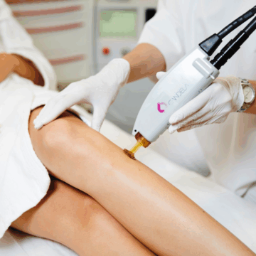 Kuo ypatingas plaukelių šalinimas lazeriu GentleMax Pro Plus? Kuo ypatingas plaukelių šalinimas lazeriu GentleMax Pro Plus?