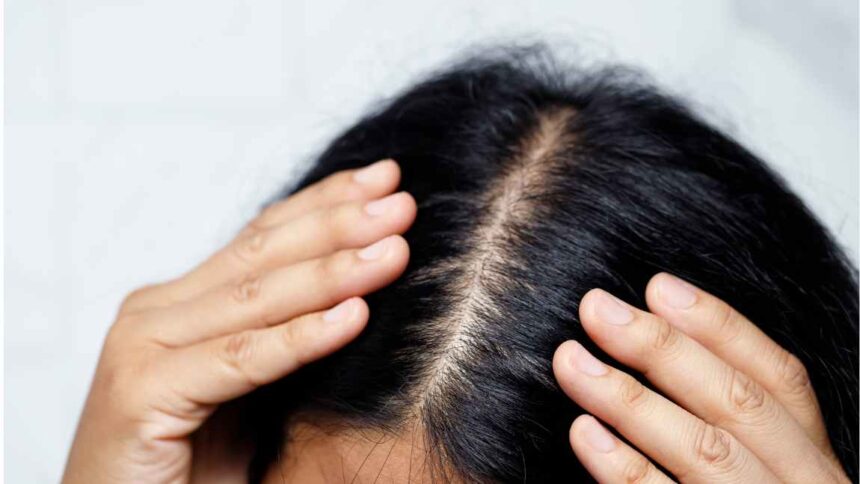 Kaip išsirinkti plaukų priežiūros priemones pagal savo plaukų tipą?